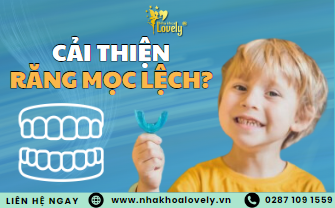 Cải thiện tình trạng răng mọc lệch